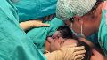 El Garrahan hizo historia: es el primer hospital público de Argentina en realizar una cirugía a una bebé dentro del útero de su madre