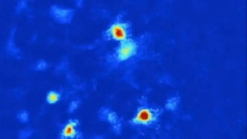 Se identificó un grupo concreto de neuronas cuya actividad descompensada es suficiente para generar comportamientos patológicos.
